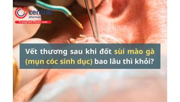 Vết thương sau khi đốt sùi mào gà (mụn cóc sinh dục) bao lâu thì khỏi?