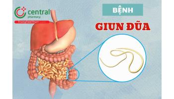 Bệnh giun đũa (Ascaris lumbricoides) có nguy hiểm không? Nguyên nhân, triệu chứng và thuốc điều trị