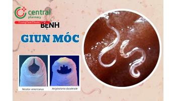 Giun móc (Ancylostoma) gây ra bệnh gì? Nguyên nhân, biểu hiện và cách phòng ngừa lây nhiễm