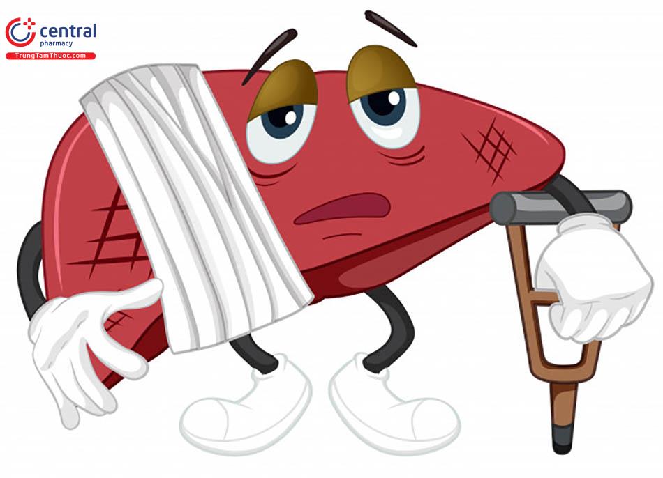 Bệnh nhân suy gan do sử dụng Paracetamol quá liều