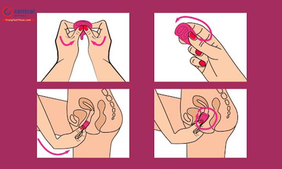 Hướng dẫn đặt cốc nguyệt san đúng cách