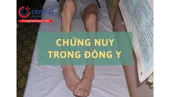 Chứng nuy trong Đông y là bệnh gì? Phương thuốc điều trị chứng nuy