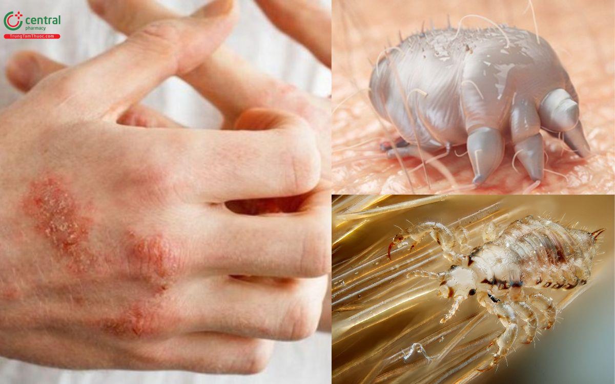 Côn trùng ký sinh