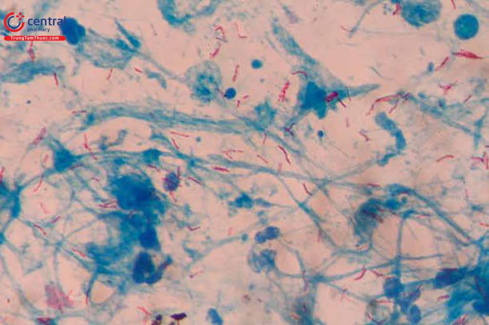 Đặc điểm của vi khuẩn lao