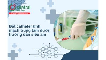 Đặt catheter tĩnh mạch trung tâm dưới hướng dẫn siêu âm