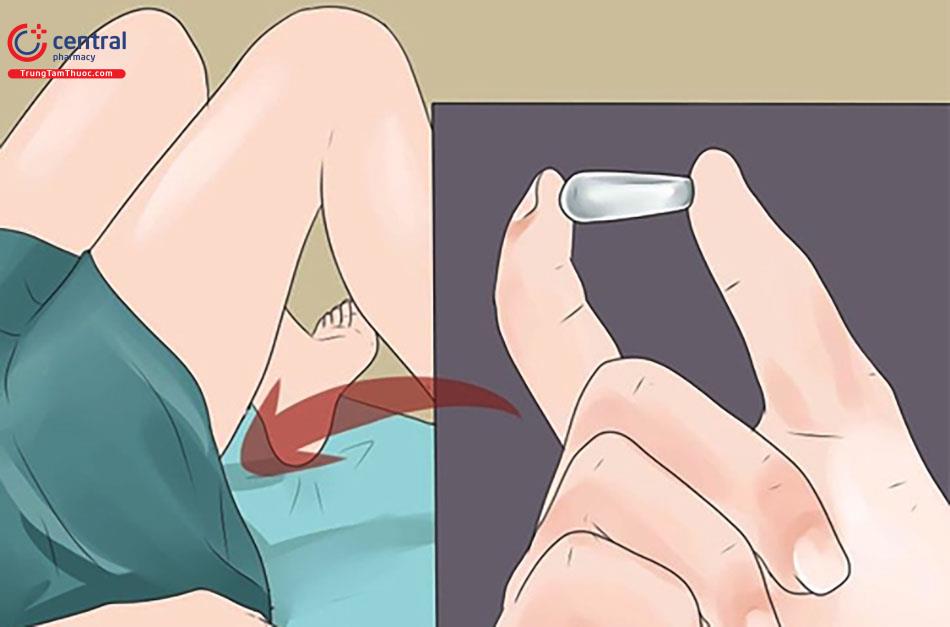 Ảnh minh hoạ đặt thuốc chống viêm nhiễm phụ khoa