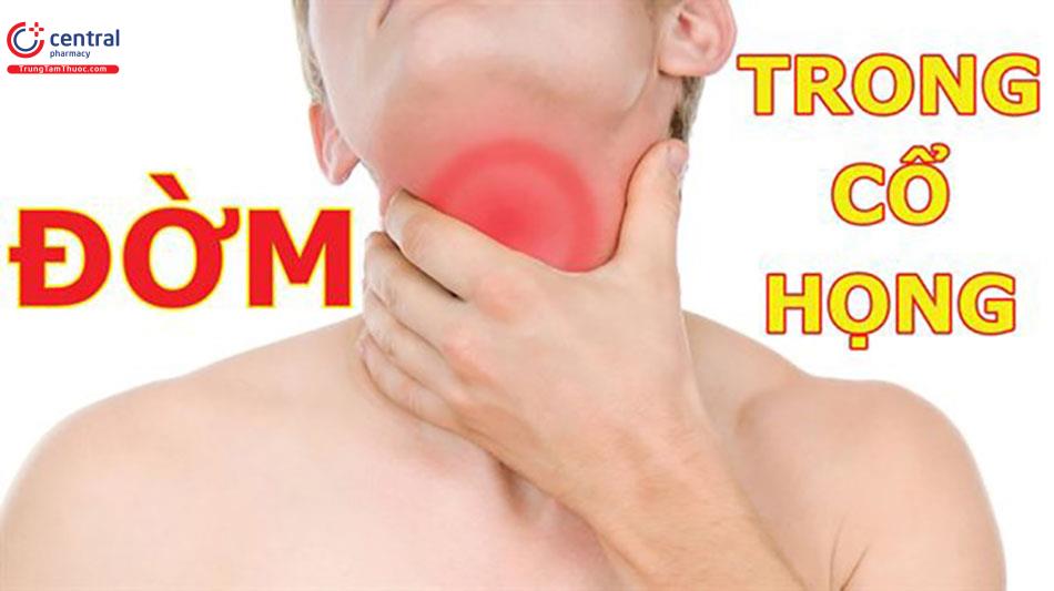 Đờm ở cổ họng