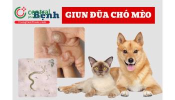 Giun đũa chó mèo (Toxocariasis) uống thuốc gì? Dấu hiệu nhiễm và phác đồ điều trị của Bộ Y tế