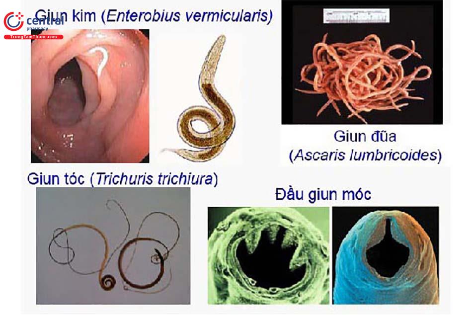 Các loại giun thường gây bệnh ở người