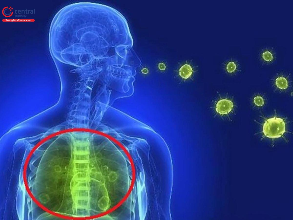 Ho thường là triệu chứng của bệnh lý viêm nhiễm đường hô hấp