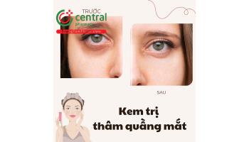 Review 5 loại kem trị thâm quầng mắt hiệu quả, giá học sinh sinh viên