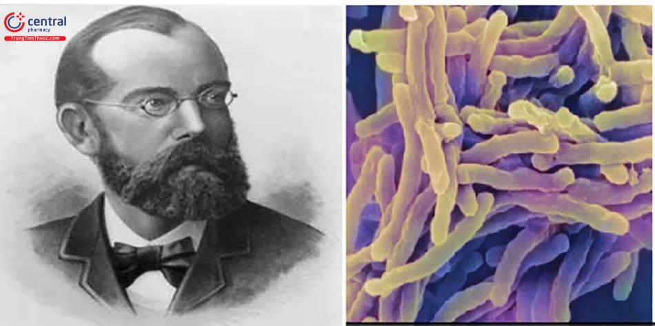 Lịch sử bệnh lao