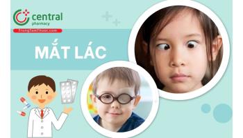 Mắt lác (mắt lé) là bệnh gì? Nguyên nhân, dấu hiệu và cách trị nhanh chóng tại nhà
