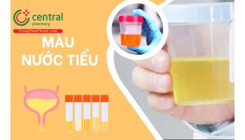 Màu nước tiểu nói lên điều gì? Dấu hiệu nào cảnh báo bệnh cần khám ngay?
