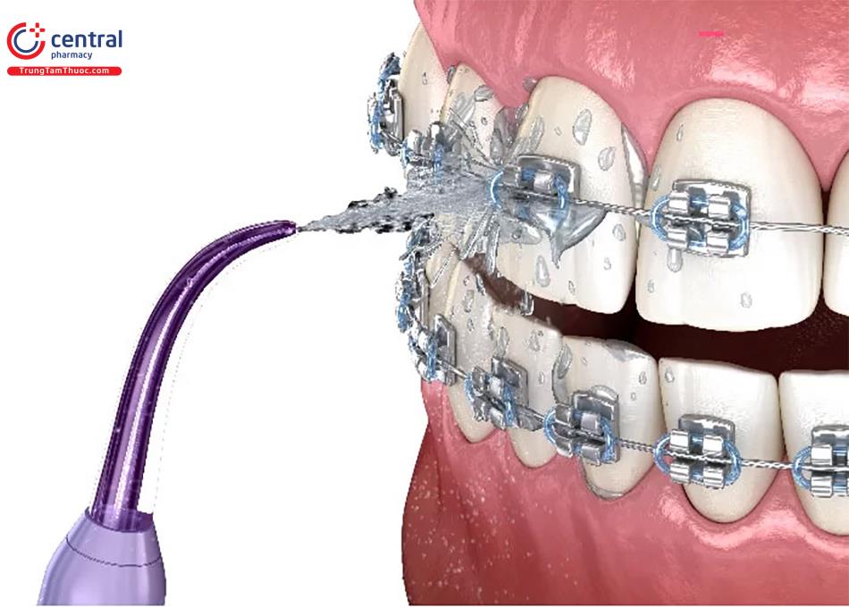 Sử dụng Máy tăm nước đúng cách