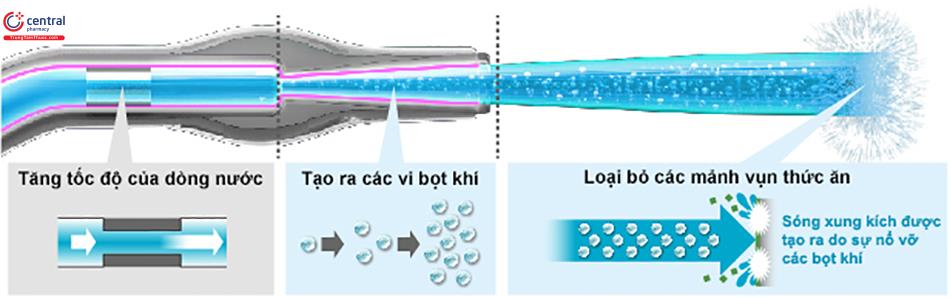 Cơ chế của công nghệ siêu âm