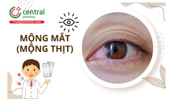 Có nên cắt mộng mắt (mộng thịt) không? Cách điều trị không cần phẫu thuật