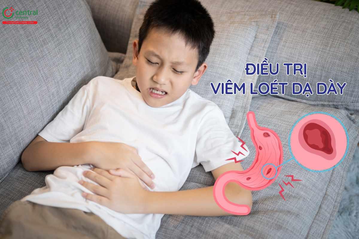 Chỉ định của Omeprazole