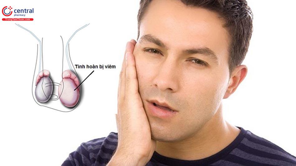 Hình ảnh người bị bệnh quai bị