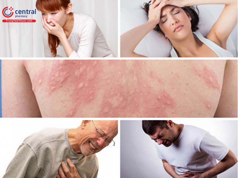 Sốc phản vệ do dùng thuốc trị lao