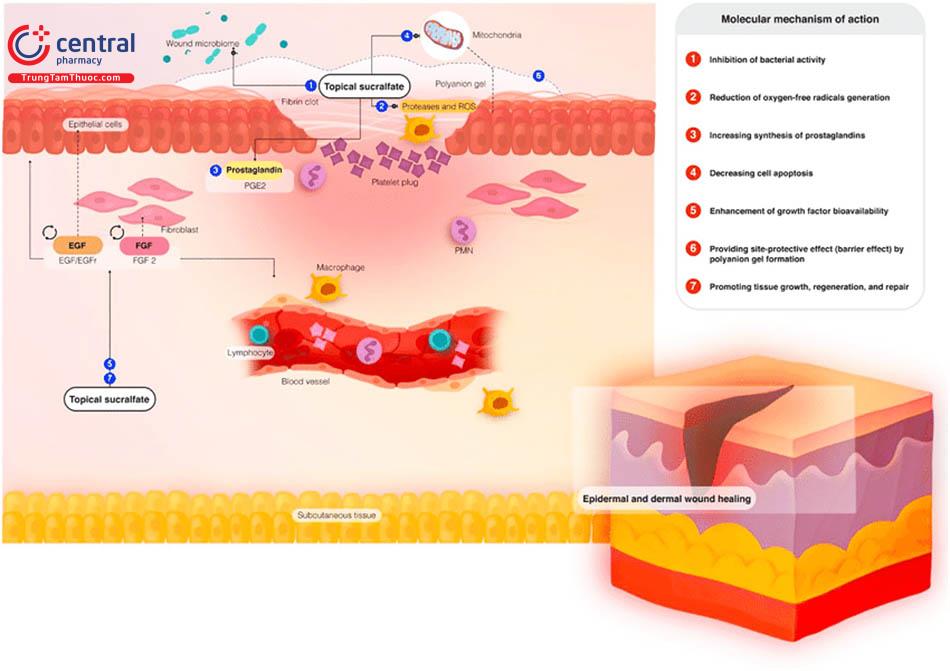 Hình 5: Cơ chế tác động của Sucrealfate lên các tổn thương tại thượng bì và hạ bì