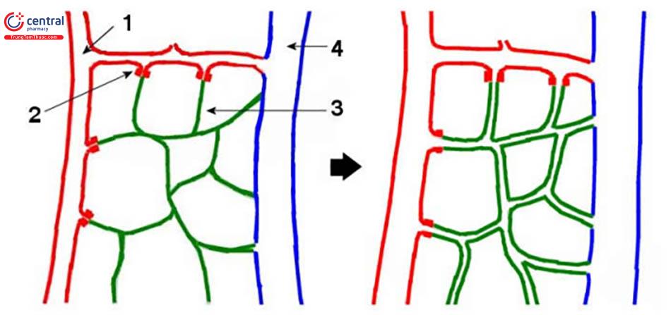 Sung huyết động mạch