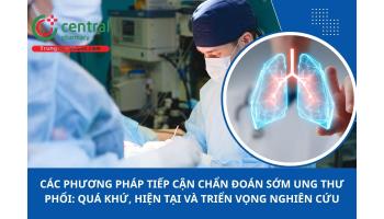 Các phương pháp tiếp cận chẩn đoán sớm ung thư phổi: quá khứ, hiện tại và triển vọng nghiên cứu
