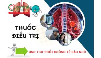 Phân loại thuốc điều trị ung thư phổi không tế bào nhỏ và phác đồ điều trị của Bộ Y tế
