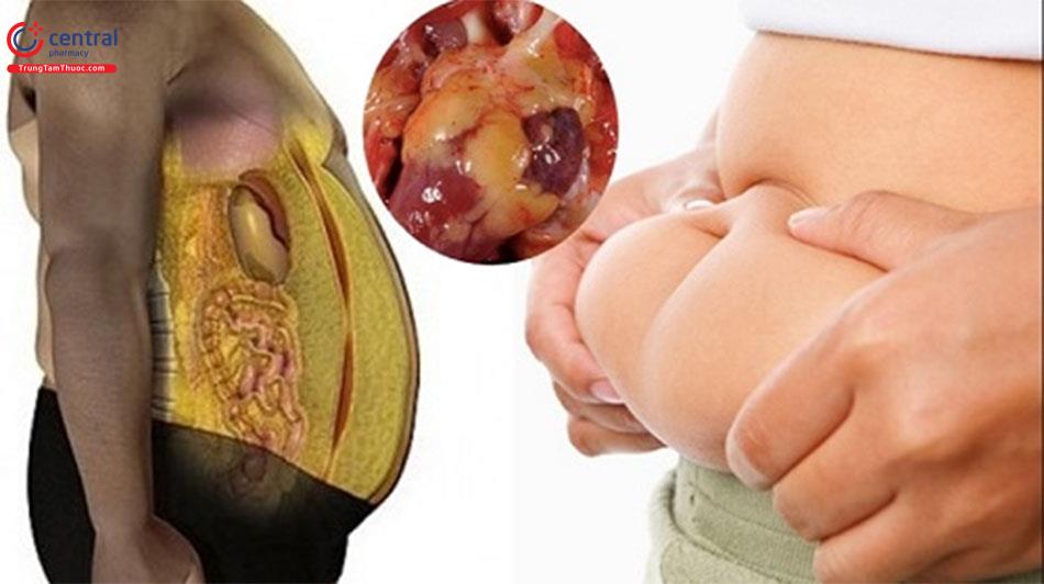 Béo phì có thể dẫn đến nhiều biến chứng nguy hiểm