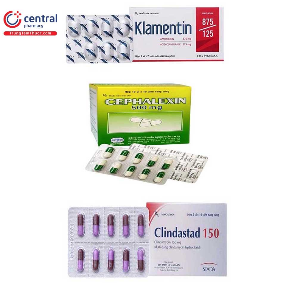 Các thuốc kháng sinh thường dùng để điều trị bệnh chốc