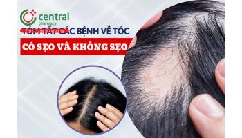 Rụng tóc có sẹo và không sẹo: biểu hiện lâm sàng, khám, điều trị