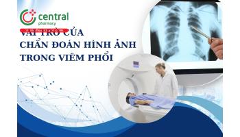 Vai trò của chẩn đoán hình ảnh trong viêm phổi 