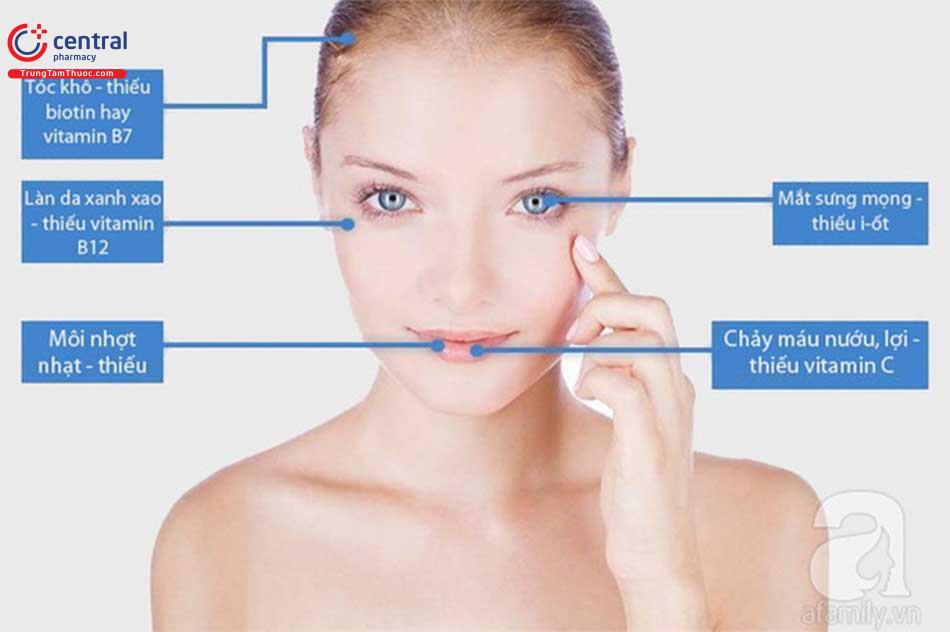 Một số triệu chứng khi thiếu vitamin