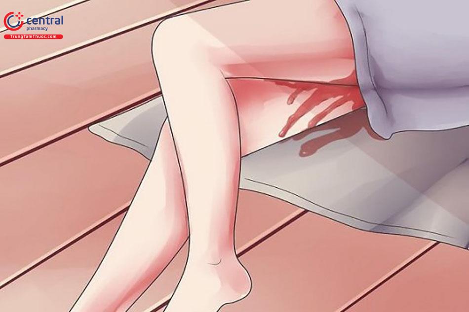 Chảy máu sau đẻ