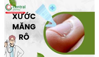 Bị xước măng rô là thiếu chất gì? Nguyên nhân và cách chữa triệt để 